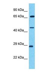Western blot of TRIM49 Antibody with HT1080 Whole Cell lysate.