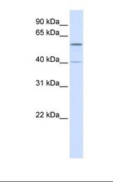 Fetal liver lysate. Antibody concentration: 1.0 ug/ml. Gel concentration: 12%.