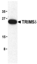 Western blot of TRIM5d expression in mouse brain cell lysate with TRIM5d antibody at 2 ug /ml.