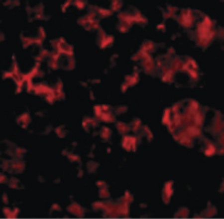 Immunofluorescence of TRIM5 alpha in Human Stomach cells with TRIM5 alpha antibody at 10 ug/ml.