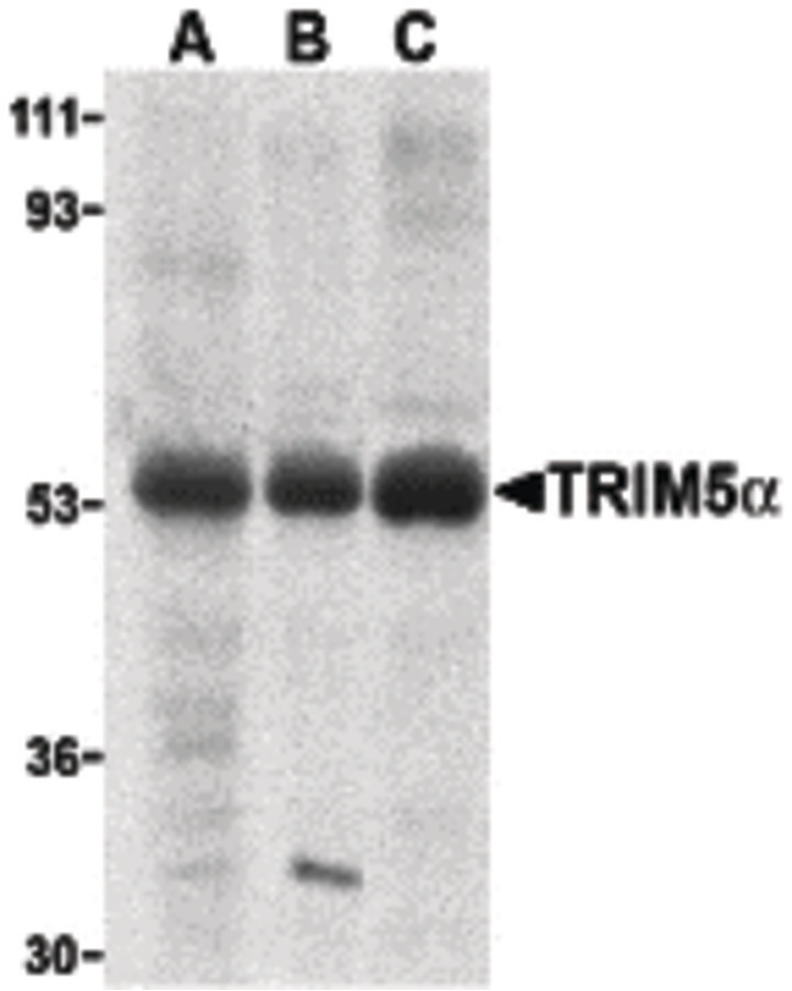 Western blot of TRIM5 alpha expression in human stomach (A), thymus (B), and uterus (C) cell lysate with TRIM5 alpha antibody at 2 ug /ml.
