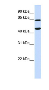 TRIM54 antibody LS-C102033 Western blot of HeLa lysate.