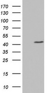 HEK293T cells were transfected with the pCMV6-ENTRY control (Left lane) or pCMV6-ENTRY TRIM54 (Right lane) cDNA for 48 hrs and lysed. Equivalent amounts of cell lysates (5 ug per lane) were separated by SDS-PAGE and immunoblotted with anti-TRIM54.