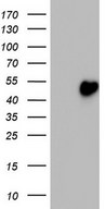 HEK293T cells were transfected with the pCMV6-ENTRY control (Left lane) or pCMV6-ENTRY TRIM54 (Right lane) cDNA for 48 hrs and lysed. Equivalent amounts of cell lysates (5 ug per lane) were separated by SDS-PAGE and immunoblotted with anti-TRIM54.