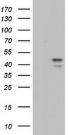 HEK293T cells were transfected with the pCMV6-ENTRY control (Left lane) or pCMV6-ENTRY TRIM54 (Right lane) cDNA for 48 hrs and lysed. Equivalent amounts of cell lysates (5 ug per lane) were separated by SDS-PAGE and immunoblotted with anti-TRIM54.