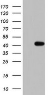 HEK293T cells were transfected with the pCMV6-ENTRY control (Left lane) or pCMV6-ENTRY TRIM54 (Right lane) cDNA for 48 hrs and lysed. Equivalent amounts of cell lysates (5 ug per lane) were separated by SDS-PAGE and immunoblotted with anti-TRIM54.
