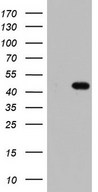 HEK293T cells were transfected with the pCMV6-ENTRY control (Left lane) or pCMV6-ENTRY TRIM54 (Right lane) cDNA for 48 hrs and lysed. Equivalent amounts of cell lysates (5 ug per lane) were separated by SDS-PAGE and immunoblotted with anti-TRIM54.