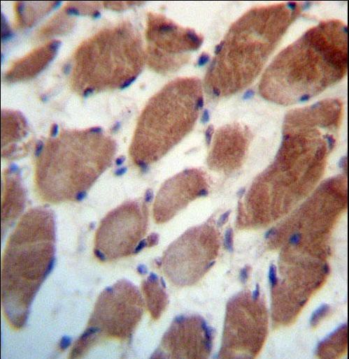 TRIM54 Antibody immunohistochemistry of formalin-fixed and paraffin-embedded human skeletal muscle followed by peroxidase-conjugated secondary antibody and DAB staining.
