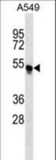 TRIM54 Antibody western blot of A549 cell line lysates (35 ug/lane). The TRIM54 antibody detected the TRIM54 protein (arrow).