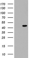 HEK293T cells were transfected with the pCMV6-ENTRY control (Left lane) or pCMV6-ENTRY TRIM54 (Right lane) cDNA for 48 hrs and lysed. Equivalent amounts of cell lysates (5 ug per lane) were separated by SDS-PAGE and immunoblotted with anti-TRIM54.