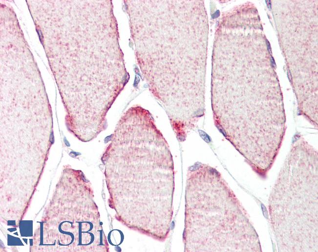 Anti-TRIM54 / MURF antibody IHC staining of human skeletal muscle. Immunohistochemistry of formalin-fixed, paraffin-embedded tissue after heat-induced antigen retrieval.