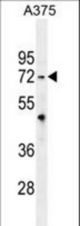TRIM56 Antibody western blot of A375 cell line lysates (35 ug/lane). The TRIM56 antibody detected the TRIM56 protein (arrow).
