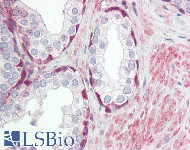 Anti-TRIM59 antibody IHC of human prostate. Immunohistochemistry of formalin-fixed, paraffin-embedded tissue after heat-induced antigen retrieval. Antibody LS-B8422 dilution 5 ug/ml.