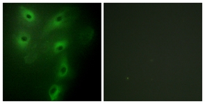 Immunofluorescence of HeLa cells, using TRIM59 Antibody. The picture on the right is treated with the synthesized peptide.