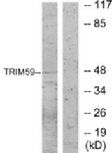 Western blot of extracts from NIH-3T3 cells, using TRIM59 Antibody. The lane on the right is treated with the synthesized peptide.