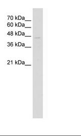 Jurkat Cell Lysate