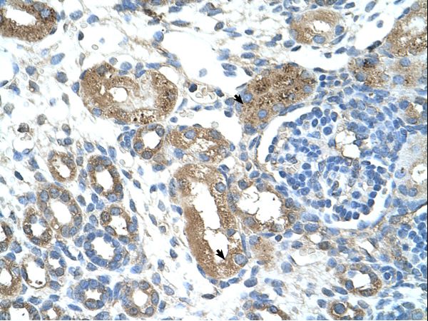 TRIM59 antibody LS-C32001 was used in IHC to stain formalin-fixed, paraffin-embedded human kidney.