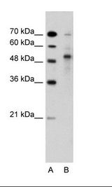 A: Marker, B: Jurkat Cell Lysate