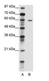 A: Marker, B: Jurkat Cell Lysate