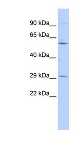 TRIM62 antibody LS-C101754 Western blot of 293T cell lysate.