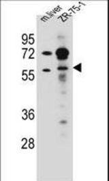 TRIM62 Antibody western blot of mouse liver tissue and ZR-75-1 cell line lysates (35 ug/lane). The TRIM62 antibody detected the TRIM62 protein (arrow).