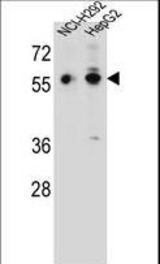 TRIM64 Antibody western blot of NCI-H292,HepG2 cell line lysates (35 ug/lane). The TRIM64 antibody detected the TRIM64 protein (arrow).