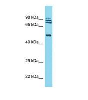 Western blot of Human Fetal Lung. TRIM64 antibody dilution 1.0 ug/ml.