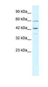 TRIM68 antibody LS-B1110 Western blot of DU145 cell lysate.