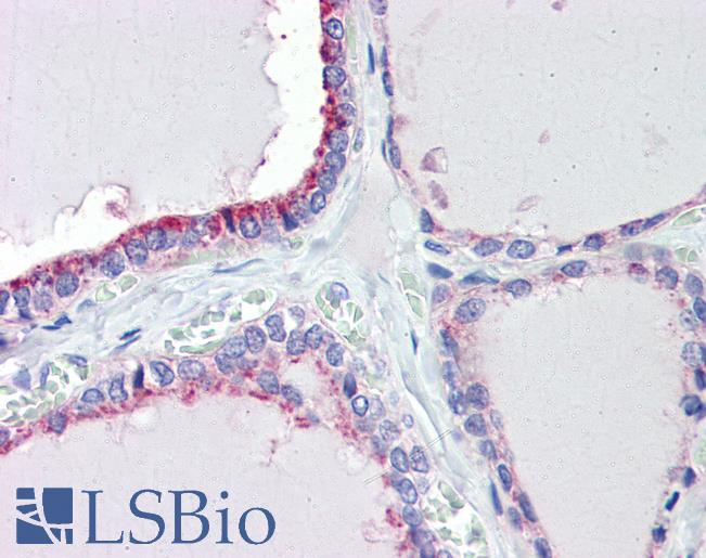 Anti-TRIM68 antibody IHC of human thyroid. Immunohistochemistry of formalin-fixed, paraffin-embedded tissue after heat-induced antigen retrieval. Antibody LS-B3531 concentration 5 ug/ml.