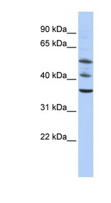 TRIM68 antibody LS-B3531 Western blot of HepG2 cell lysate.