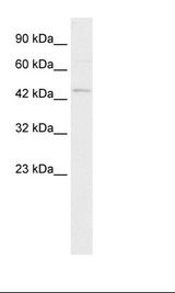 Jurkat Cell Lysate