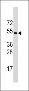 Western blot of anti-TRIM69 Antibody (Center K251) (RB13944) in HL60 cell line lysates (35 ug/lane). TRIM69(arrow) was detected using the purified antibody.