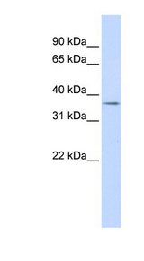 TRIM69 / RNF36 antibody LS-C109965 Western blot of Fetal Heart lysate.