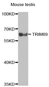 Western blot analysis of extracts of mouse testis tissue lines, using TRIM69 antibody.