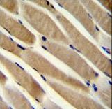 TRIM7 Antibody immunohistochemistry of formalin-fixed and paraffin-embedded human skeletal muscle followed by peroxidase-conjugated secondary antibody and DAB staining.