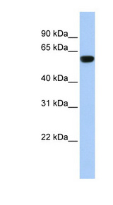 TRIM72 antibody LS-C101995 Western blot of Fetal Muscle lysate.