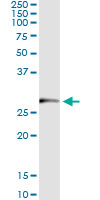Immunoprecipitation of TRIM72 transfected lysate using anti-TRIM72 monoclonal antibody and Protein A Magnetic Bead.