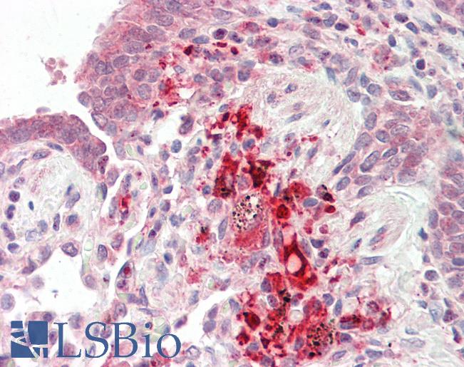 Anti-TRIM72 / MG53 antibody IHC staining of human lung, macrophages. Immunohistochemistry of formalin-fixed, paraffin-embedded tissue after heat-induced antigen retrieval. Antibody LS-B9730 concentration 10 ug/ml.