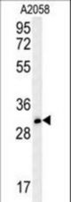 TRI73 Antibody western blot of A2058 cell line lysates (35 ug/lane). The TRI73 antibody detected the TRI73 protein (arrow).