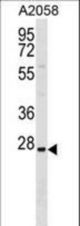 TRIM74 Antibody western blot of A2058 cell line lysates (35 ug/lane). The antibody detected the protein (arrow).