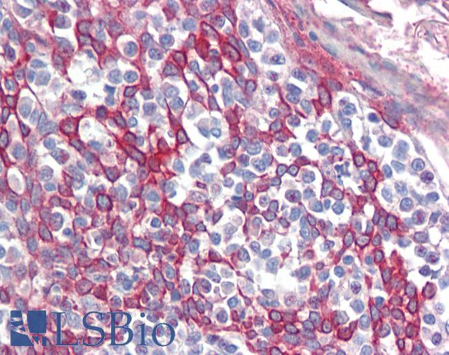 Anti-TRIM8 / GERP antibody IHC of human tonsil. Immunohistochemistry of formalin-fixed, paraffin-embedded tissue after heat-induced antigen retrieval. Antibody LS-B3536 concentration 5 ug/ml.