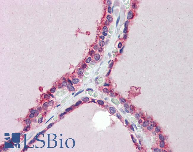 Anti-TRIM8 / GERP antibody IHC of human thyroid. Immunohistochemistry of formalin-fixed, paraffin-embedded tissue after heat-induced antigen retrieval. Antibody LS-B3536 concentration 5 ug/ml.