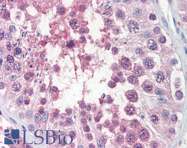 Anti-TRIM8 / GERP antibody IHC of human testis. Immunohistochemistry of formalin-fixed, paraffin-embedded tissue after heat-induced antigen retrieval. Antibody LS-B3536 concentration 5 ug/ml.