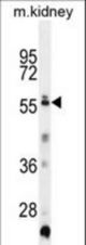 TRIML1 Antibody western blot of mouse kidney tissue lysates (35 ug/lane). The TRIML1 antibody detected the TRIML1 protein (arrow).