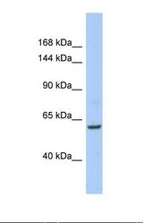 Western blot of Human 721_B. TRIO antibody dilution 1.0 ug/ml.