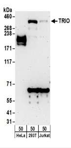 Detection of Human TRIO by Western Blot. Samples: Whole cell lysate (50 ug) from HeLa, 293T, and Jurkat cells. Antibodies: Affinity purified rabbit anti-TRIO antibody used for WB at 0.4 ug/ml. Detection: Chemiluminescence with an exposure time of 3 minutes.