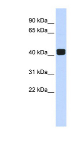 TRIOBP antibody LS-C109959 Western blot of Fetal Brain lysate.