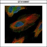 Confocal immunofluorescence analysis (Olympus FV10i) of paraformaldehyde-fixed HeLa using Tara antibody (Green) at 1:500 dilution. Alpha-tubulin filaments were labeled with alpha-tubulin antibody (Red) at 1:2500.