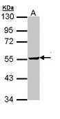 Sample (30 ug of whole cell lysate). A: HeLa. 10% SDS PAGE. TRIOBP antibody diluted at 1:1000