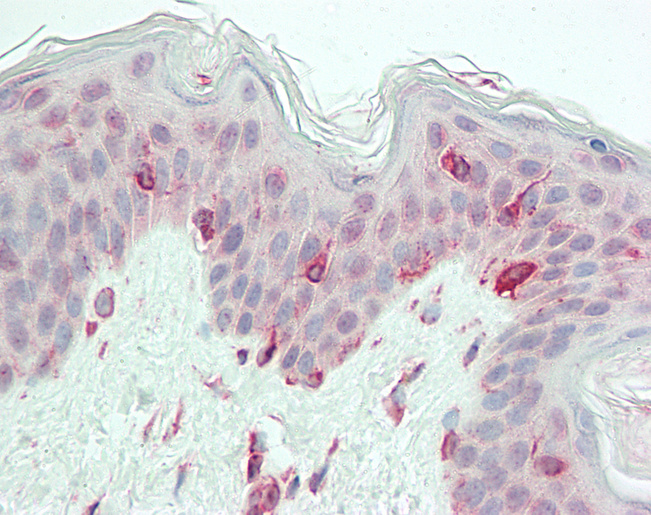 Human Skin: Formalin-Fixed, Paraffin-Embedded (FFPE)